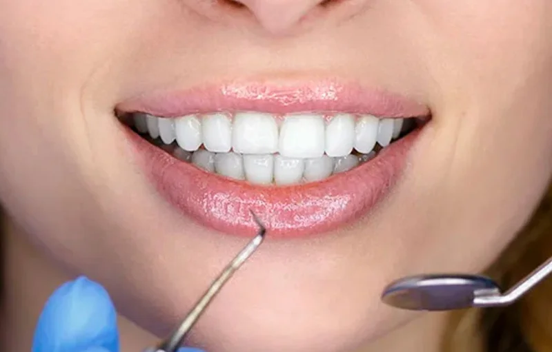 El poder de la odontología preventiva: mantenga su sonrisa sana de por vida