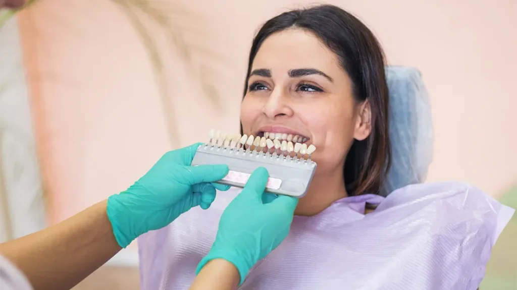 ¿Qué es una corona dental y cuándo la necesitas?