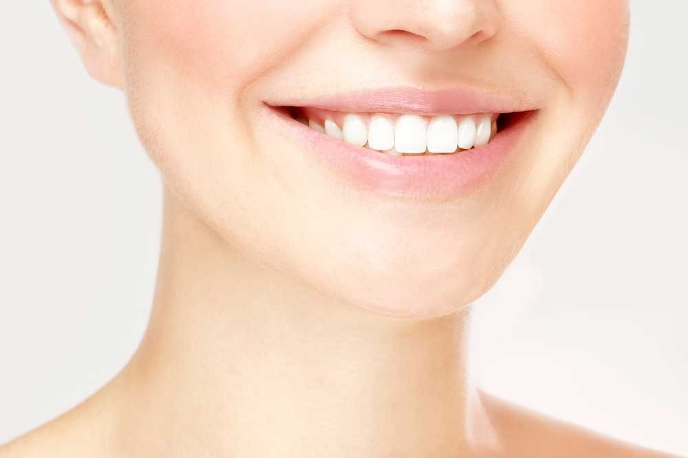 Mejore su sonrisa con carillas: un camino sencillo hacia una apariencia radiante